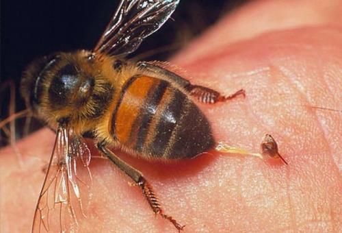Чем помазать укус пчелы в домашних условиях. Как помочь пострадавшему в домашних условиях и «в поле»