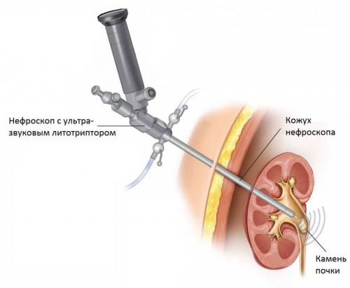 Польза и вред ягод и листьев крыжовника. Северный виноград: польза, вред и кулинарное применение крыжовника 05