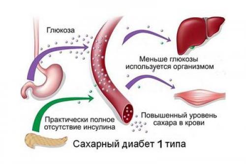 Что можно кушать при сахарном диабете. Степени болезни 05 Что можно кушать при сахарном диабете. Степени болезни 05