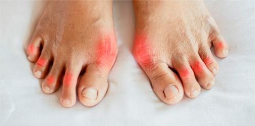 Влияние употребления красного вина на микробиом человека. Пивные полифенолы, кишечный микробиом и здоровье 01 Влияние употребления красного вина на микробиом человека. Пивные полифенолы, кишечный микробиом и здоровье 01