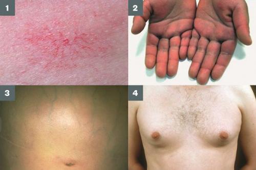 Функции печени в нормализации избыточного веса. Диетотерапия и модификация образа жизни 01 Функции печени в нормализации избыточного веса. Диетотерапия и модификация образа жизни 01