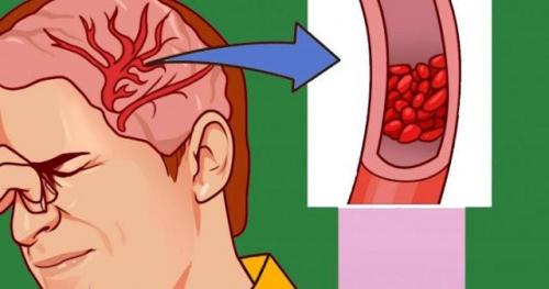 Двенадцать признаков нехватки магния. 12 серьезных предупреждающих знаков о низком уровне магния в организме