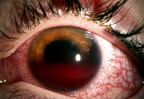 Способы оказания первой медицинской помощи при травмах 04