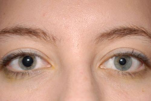 Способы оказания первой медицинской помощи при травмах 03