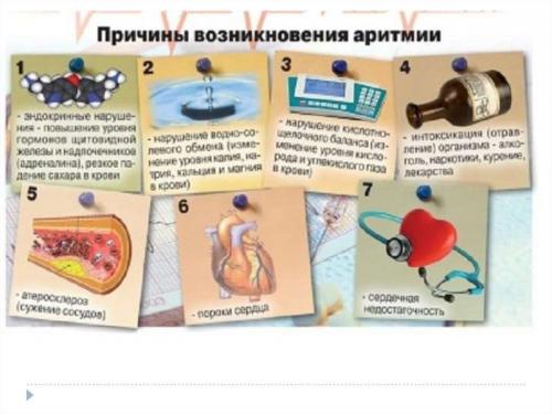 Как убрать перебои в сердце. Причины аритмии