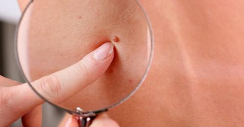 Вздутие живота у 3-х месячного кролика. Лечение метеоризма у кроликов 02