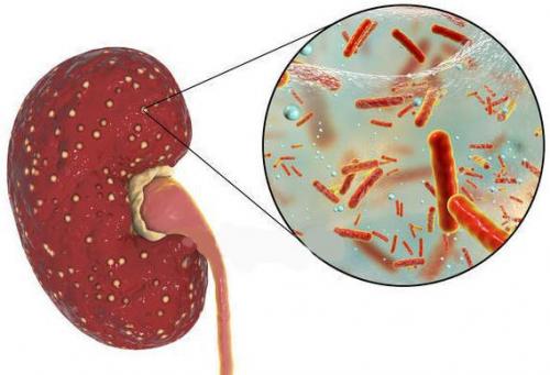 Неотложная помощь при остром пиелонефрите и гематурии. Неотложная помощь при гематурии 01 Неотложная помощь при остром пиелонефрите и гематурии. Неотложная помощь при гематурии 01