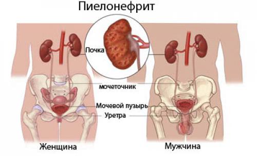 Неотложная помощь при остром пиелонефрите и гематурии. Неотложная помощь при гематурии 02 Неотложная помощь при остром пиелонефрите и гематурии. Неотложная помощь при гематурии 02