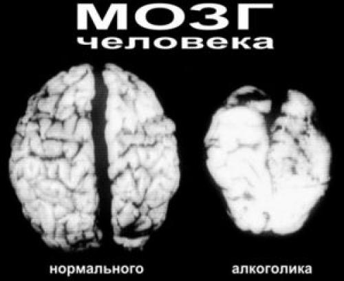 Вред алкоголя кратко. Влияние алкоголя на здоровье человека