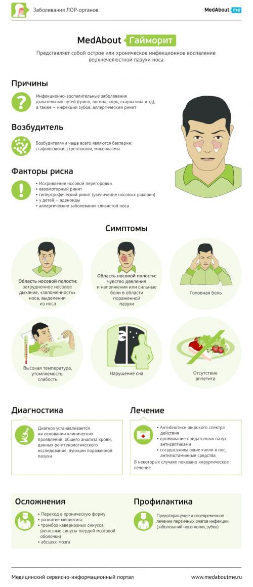 Что такое коды МКБ-10 Гайморит Что такое коды МКБ-10 Гайморит
